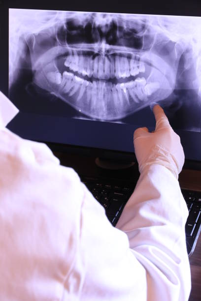 Best Emergency Tooth Extraction in San Bruno, CA