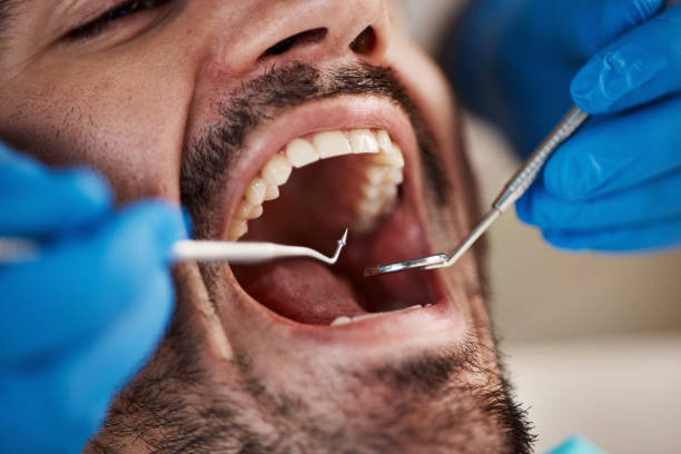 Best Cosmetic Emergency Dentistry in San Bruno, CA